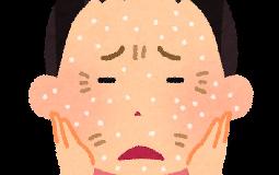 乾燥の季節です、、、