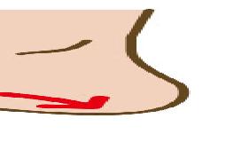 その疲れ、足の裏の問題かも？